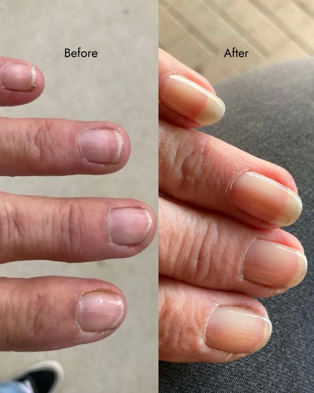 Nail Strengthener - Image 3